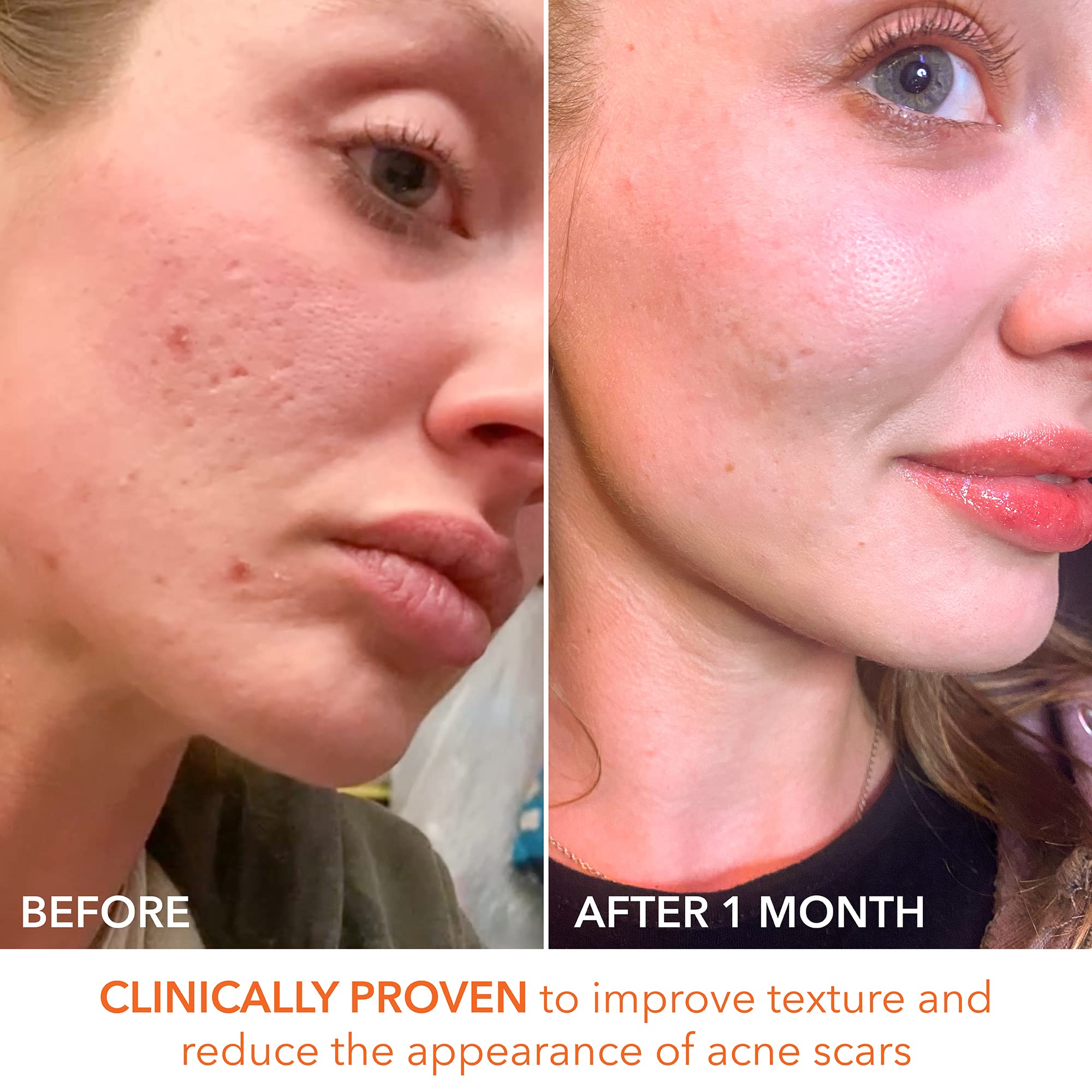 Dr Dennis Gross Smooth finish and radiant complexion with consistent exfoliation.