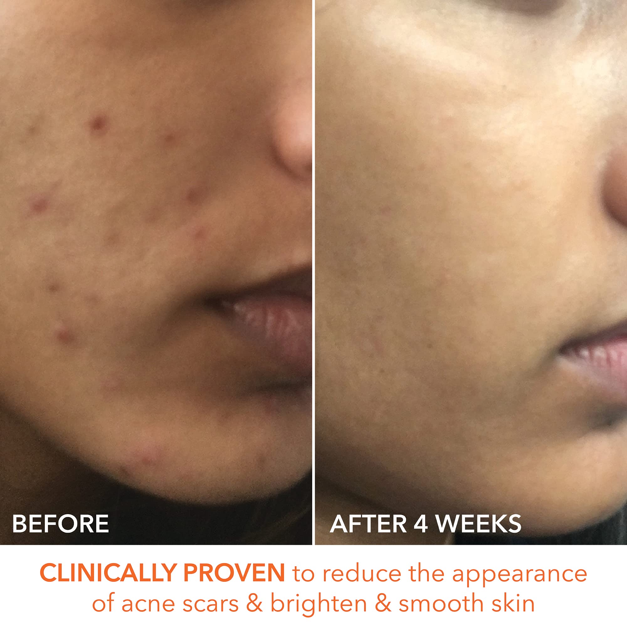 Ready-to-use exfoliation routine offering potential for radiant skin.