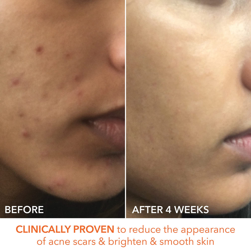 Ready-to-use exfoliation routine offering potential for radiant skin.
