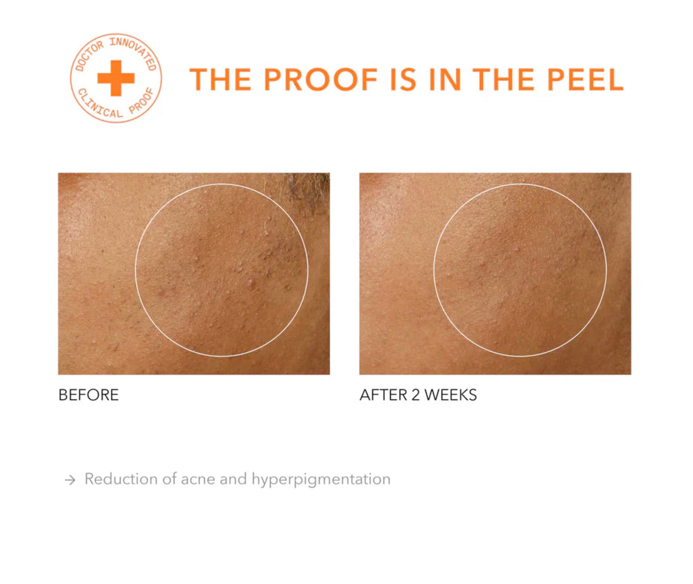 Dr Dennis Gross Alpha Beta Universal Daily Peel product on bathroom shelf with clean aesthetic.