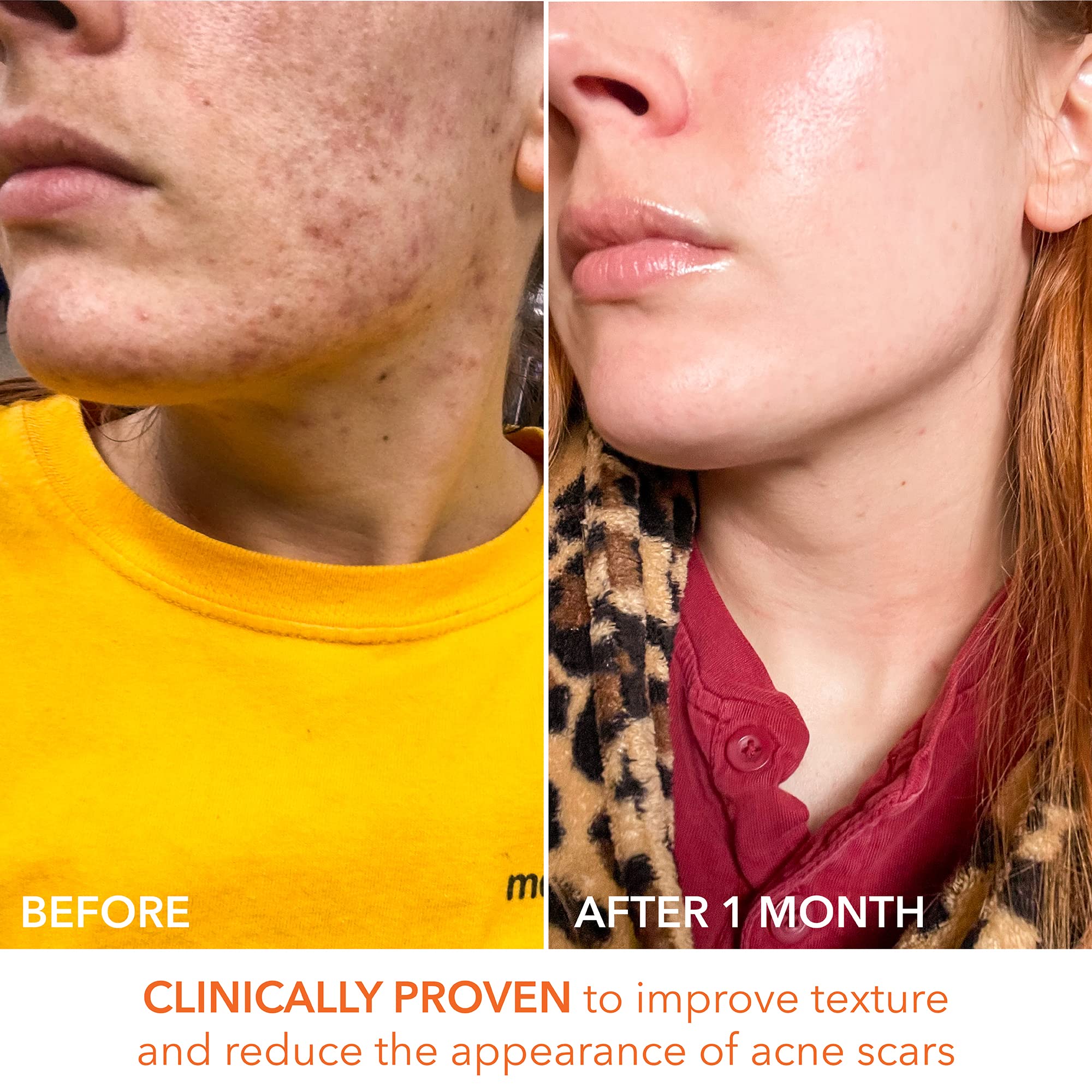 Dr Dennis Gross Alpha Beta Universal Daily Peel countertop shot conveys premium skincare experience.