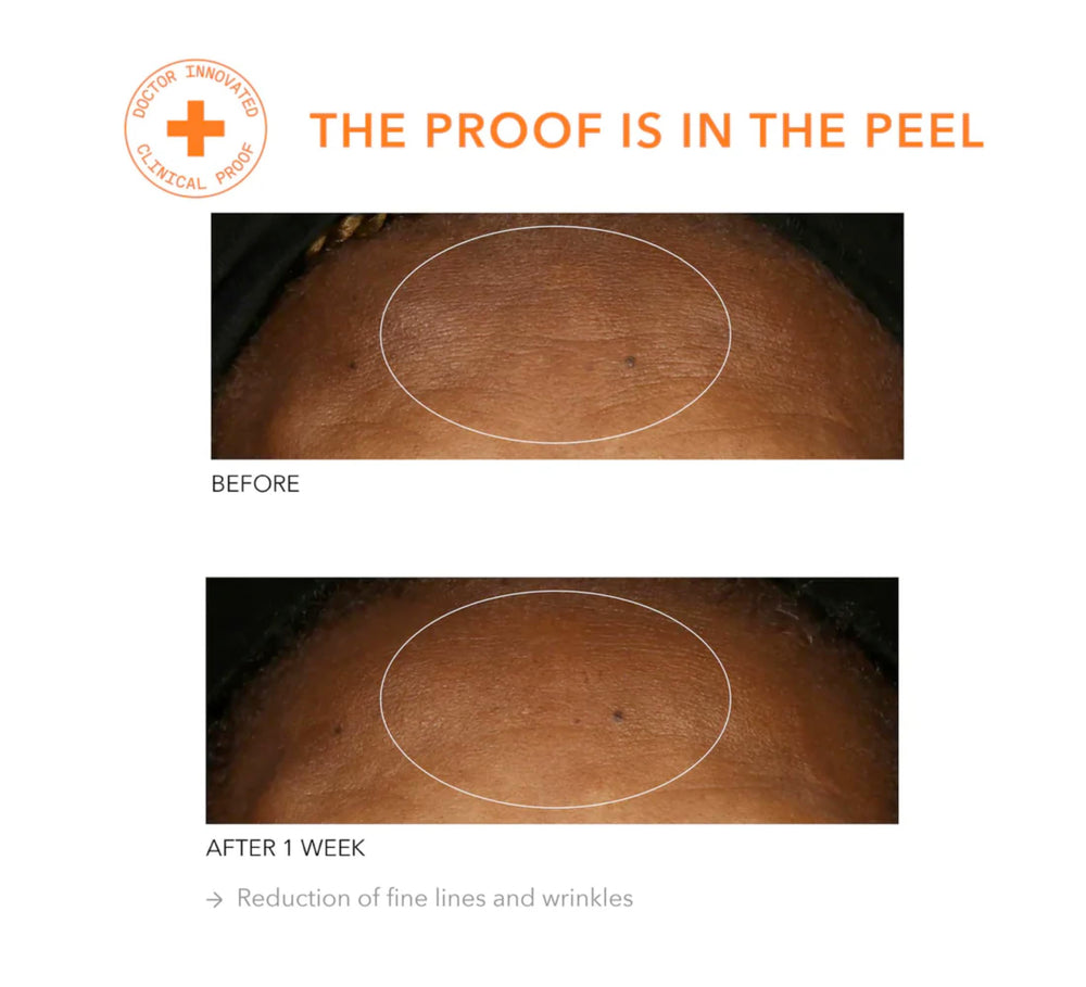 Dr Dennis Gross Alpha Beta Universal Daily Peel bottle with soft lighting suggesting anti-aging actives.