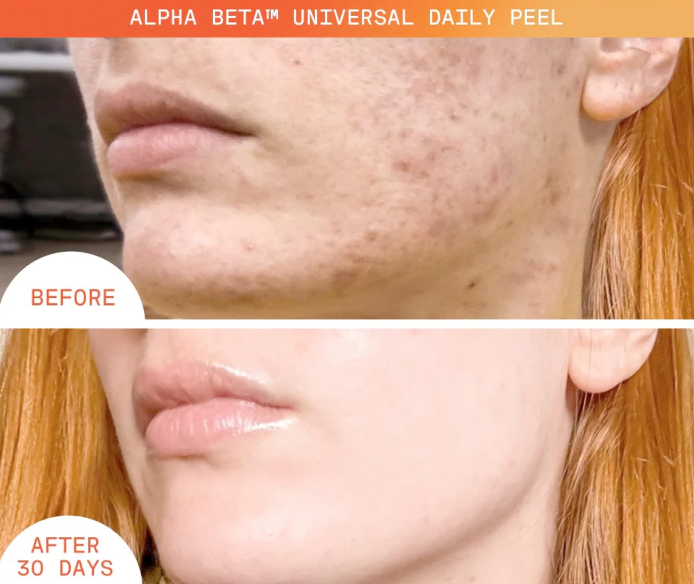 Dr Dennis Gross Alpha Beta Universal Daily Peel tester patch illustrating improved texture.