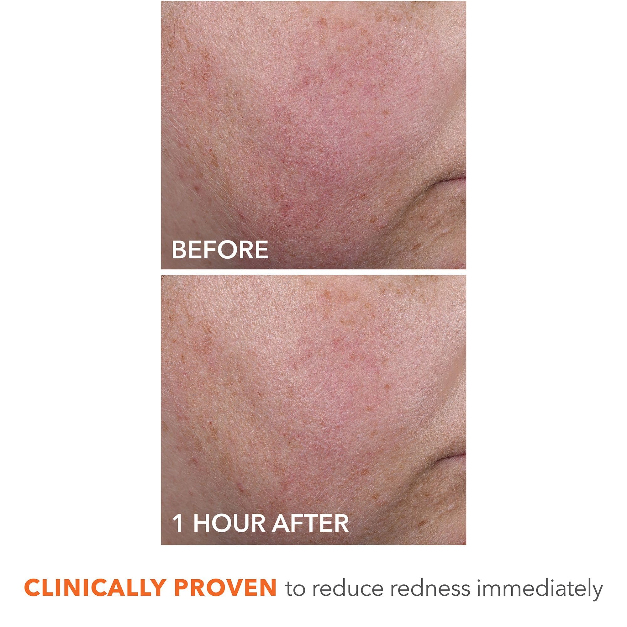 Redness-minimized look for more even-toned skin with DermInfusions.
