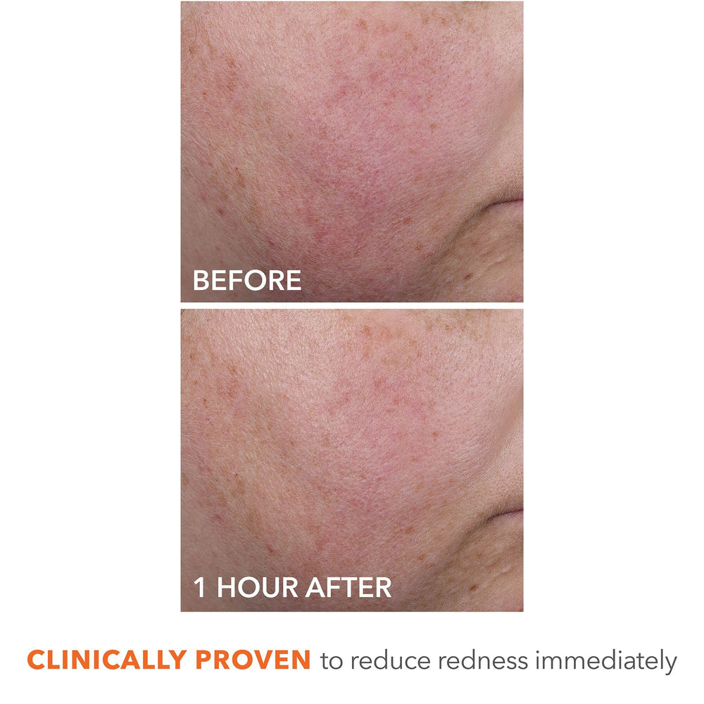 Redness-minimized look for more even-toned skin with DermInfusions.