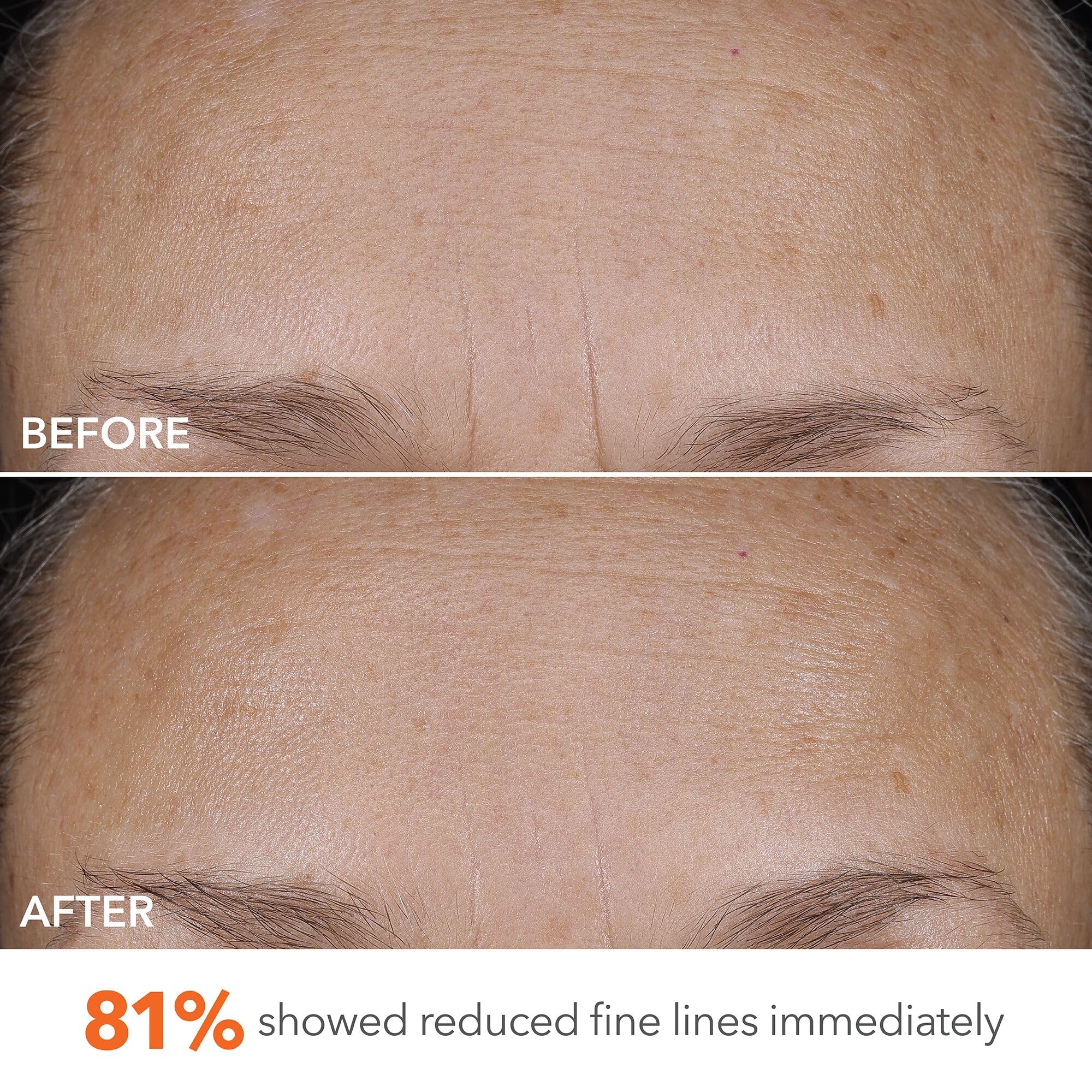 Ingredients highlight peptides and multi-weight hyaluronic acid benefits.