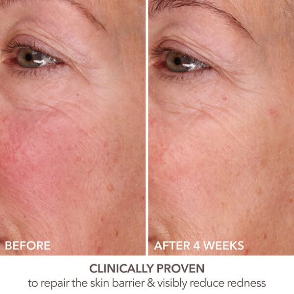 Dr Dennis Gross DermInfusions Fill + Repair serum after use provides subtle moisture glow