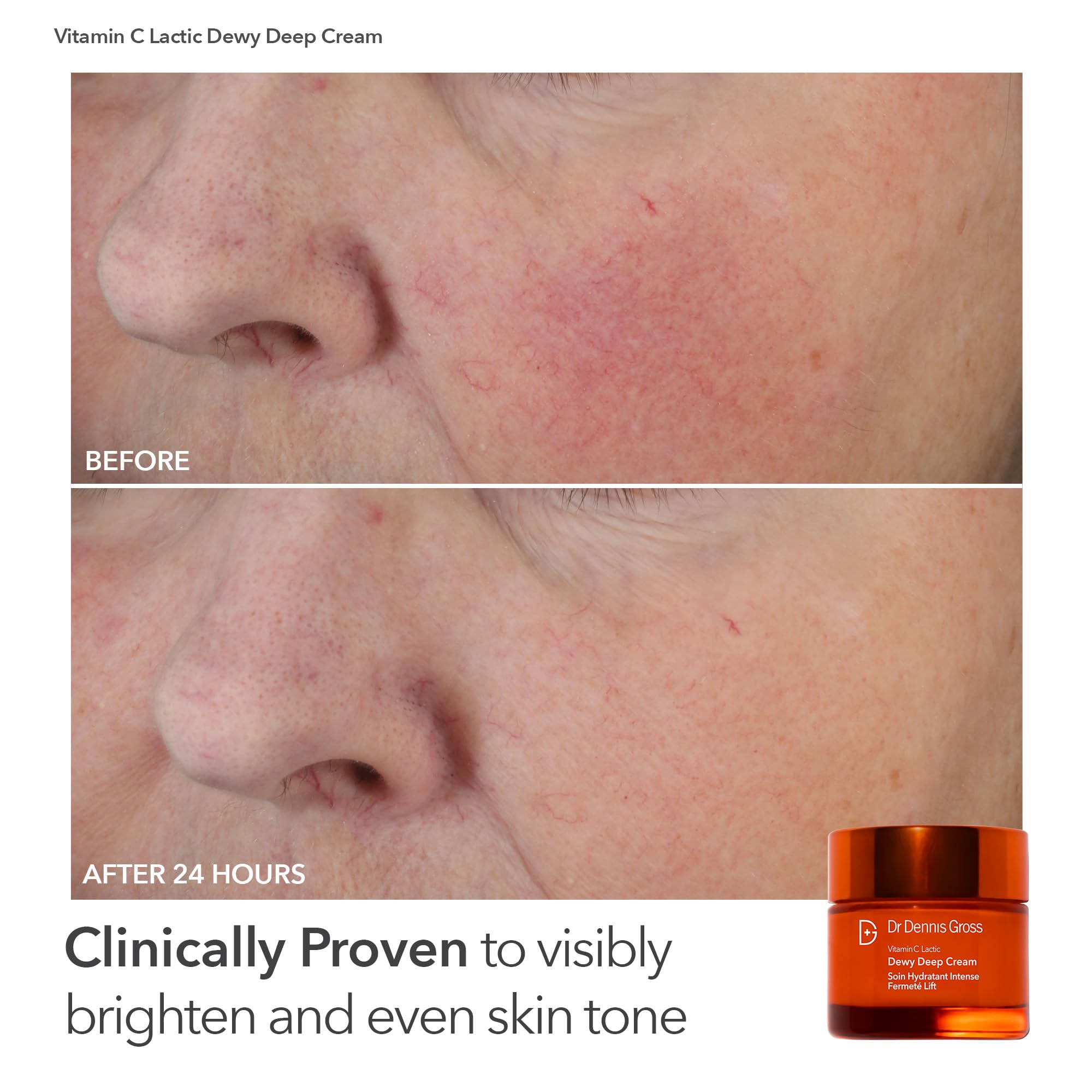 Dr Dennis Gross LED therapy spotlight for skin-supportive routines