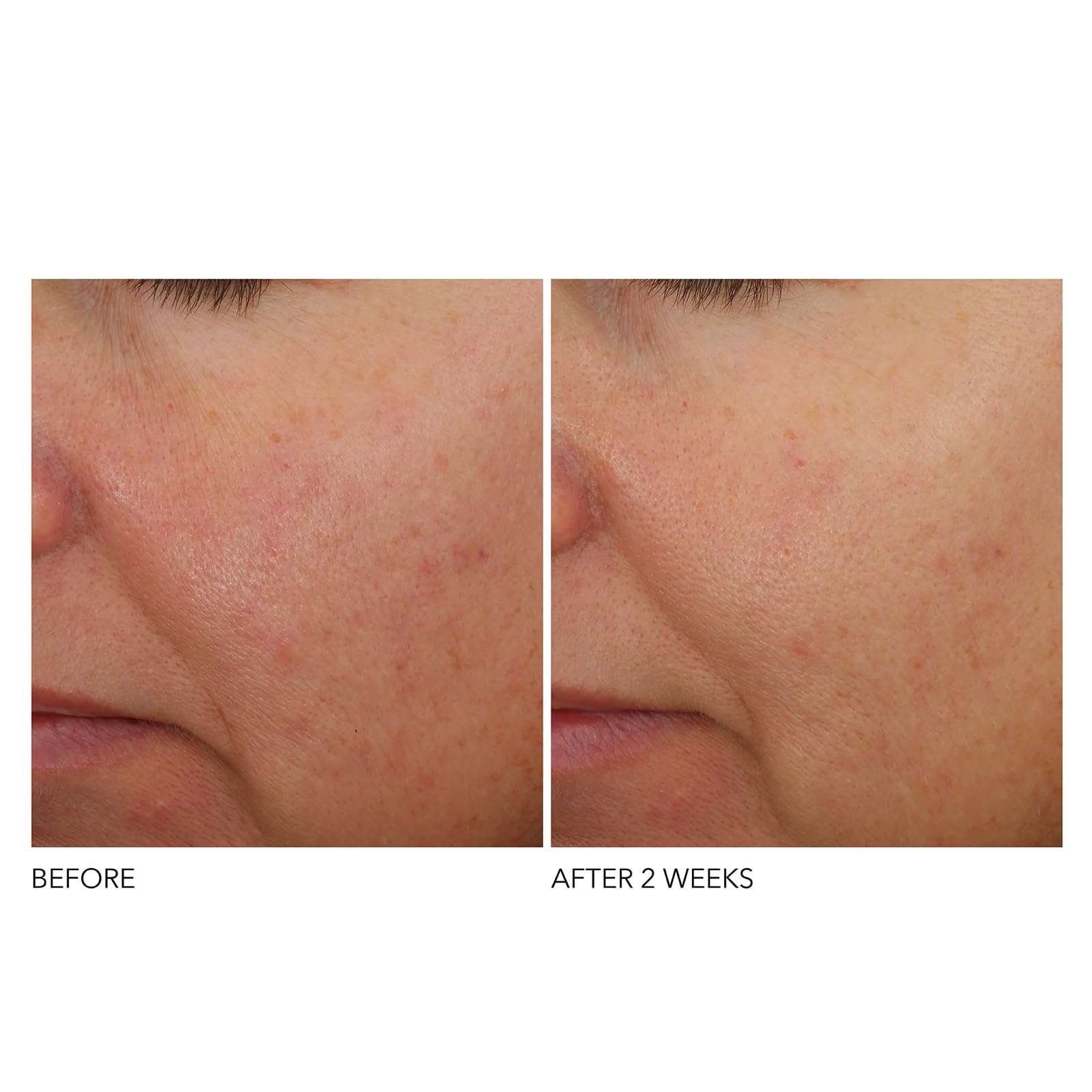 Dr Dennis Gross Niacinamide focus image highlights moisture barrier support.