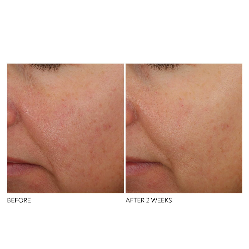Dr Dennis Gross Niacinamide focus image highlights moisture barrier support.