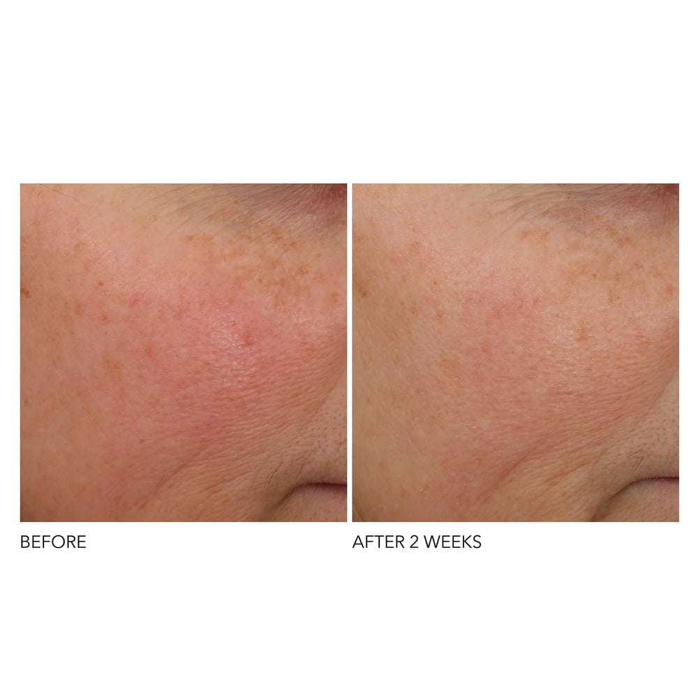 Dr Dennis Gross overnight-application pump-action demonstrates easy PM use.