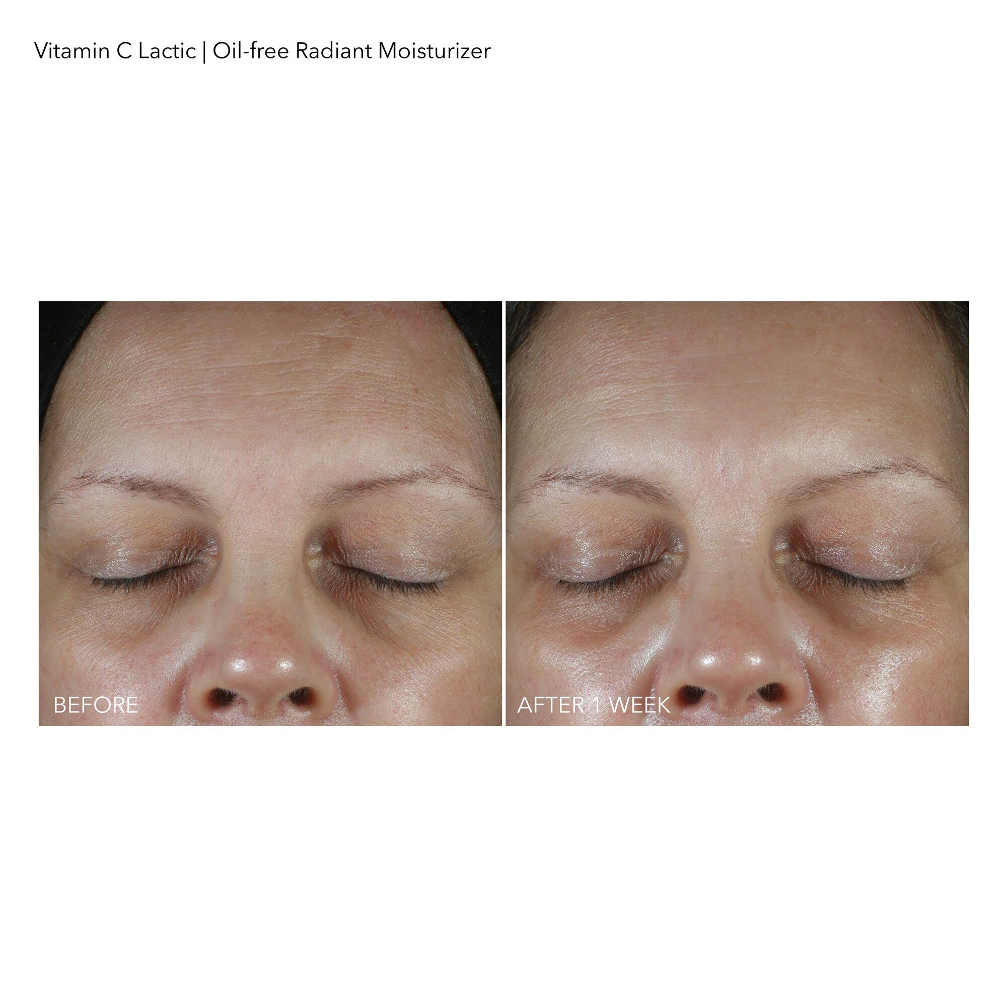 Dr Dennis Gross radiance glow on skin after use