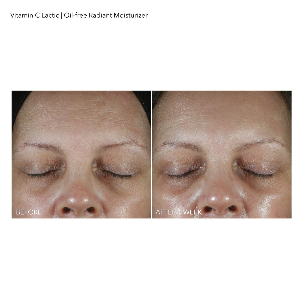 Dr Dennis Gross radiance glow on skin after use