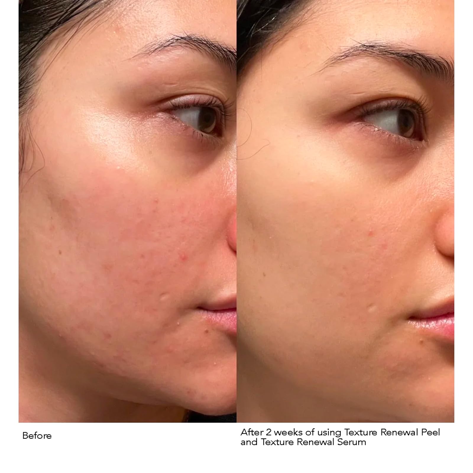 Dr Dennis Gross squalane and hyaluronic acid hydration boost