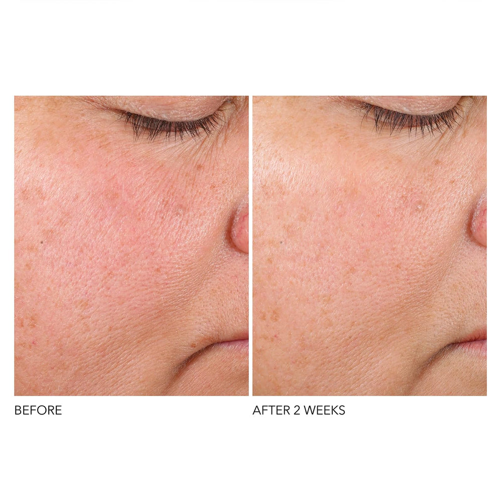 Dr Dennis Gross serum texture close-up showing smoothing effect