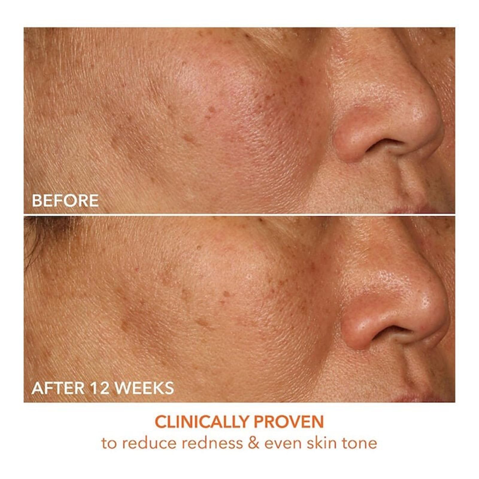 Close-up of texture shows glow after applying Dr Dennis Gross Vitamin C Lactic serum.
