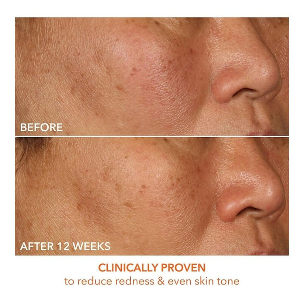 Close-up of texture shows glow after applying Dr Dennis Gross Vitamin C Lactic serum.