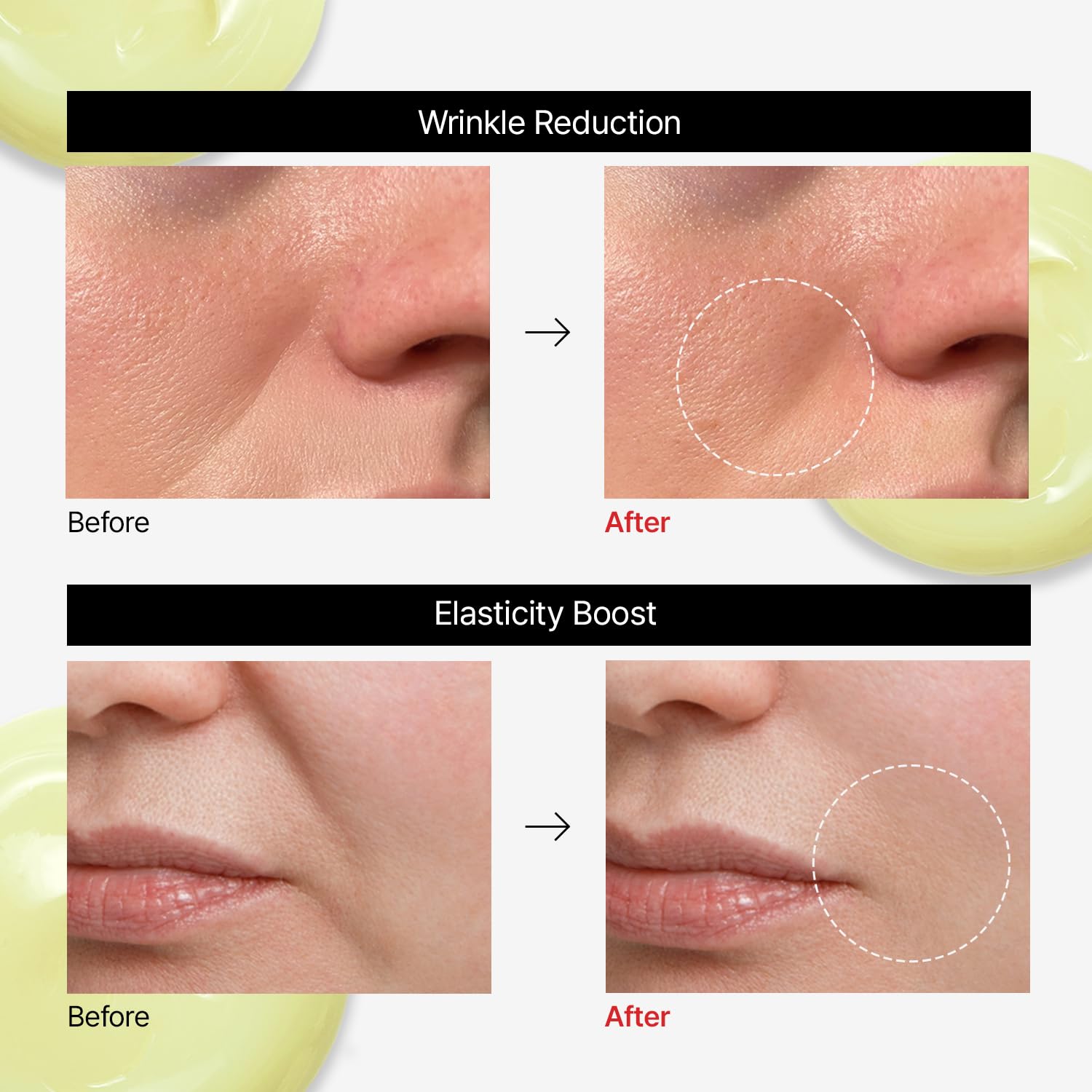 Dr.Different VITALIFT-A Forte airless-tube packaging protects potency