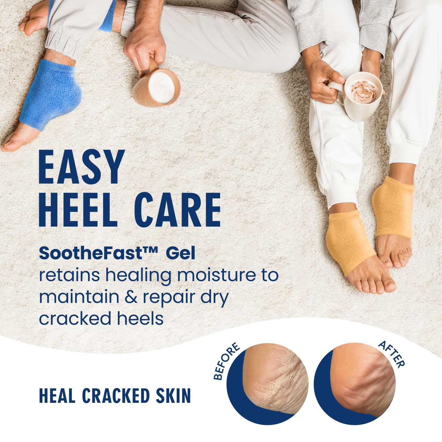 Dr. Frederick's Original fuzzy heel socks in use on feet for overnight moisture and softness