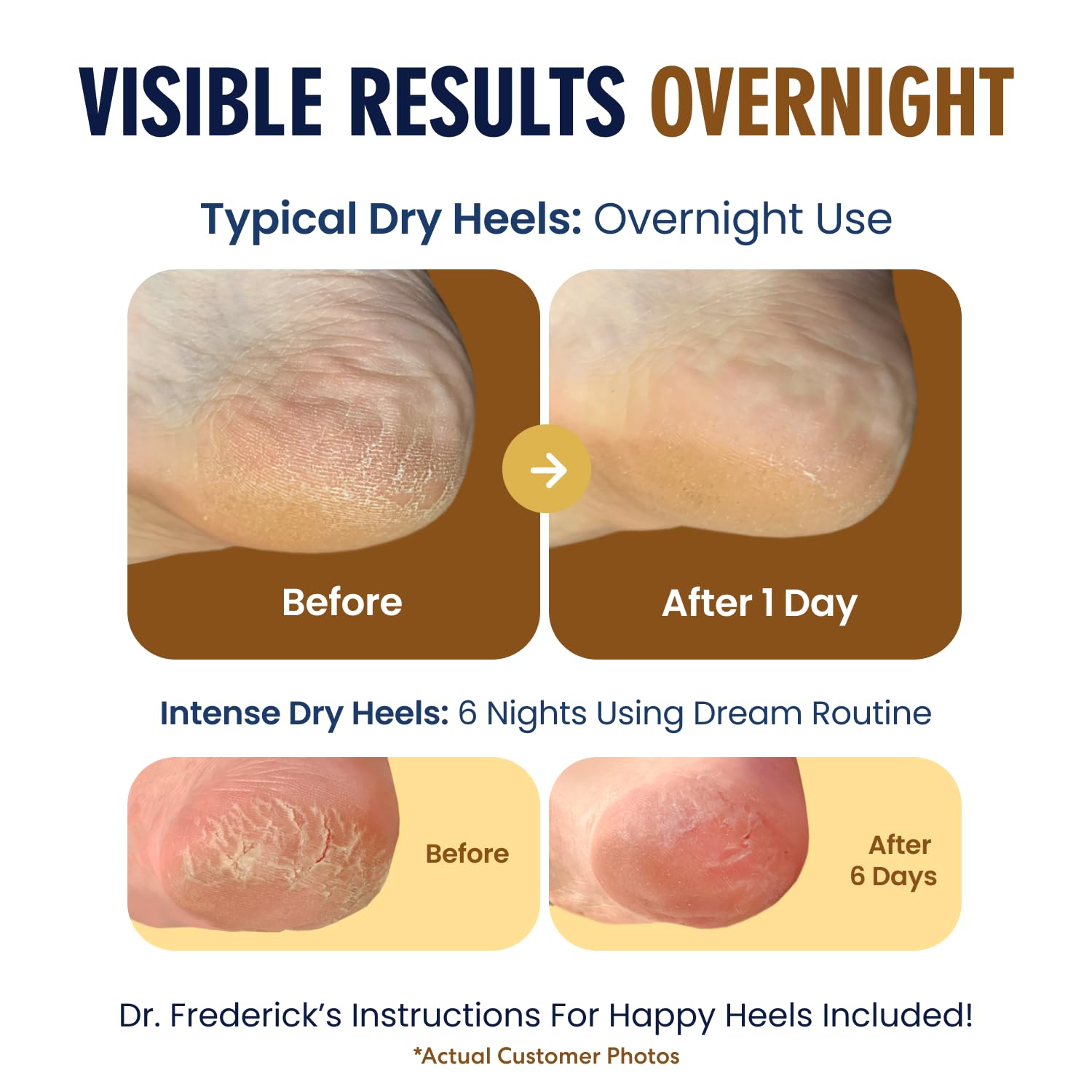 Dr. Frederick's Original Moisturizing Fuzzy Heel Socks wide-fit for comfortable all-foot sizing.