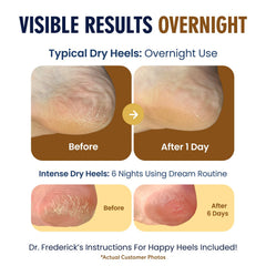 Dr. Frederick's Original Moisturizing Fuzzy Heel Socks wide-fit for comfortable all-foot sizing.