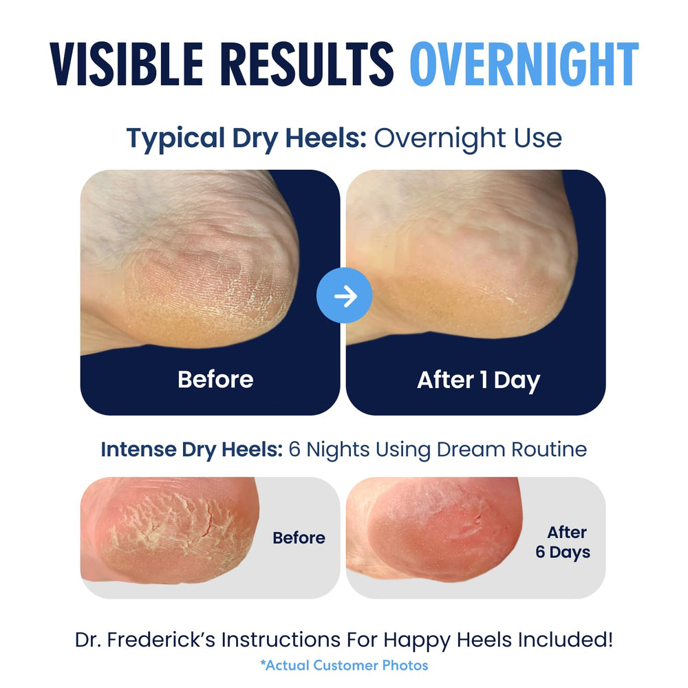 Nighttime use with Dr. Frederick's Original socks for gentle care.