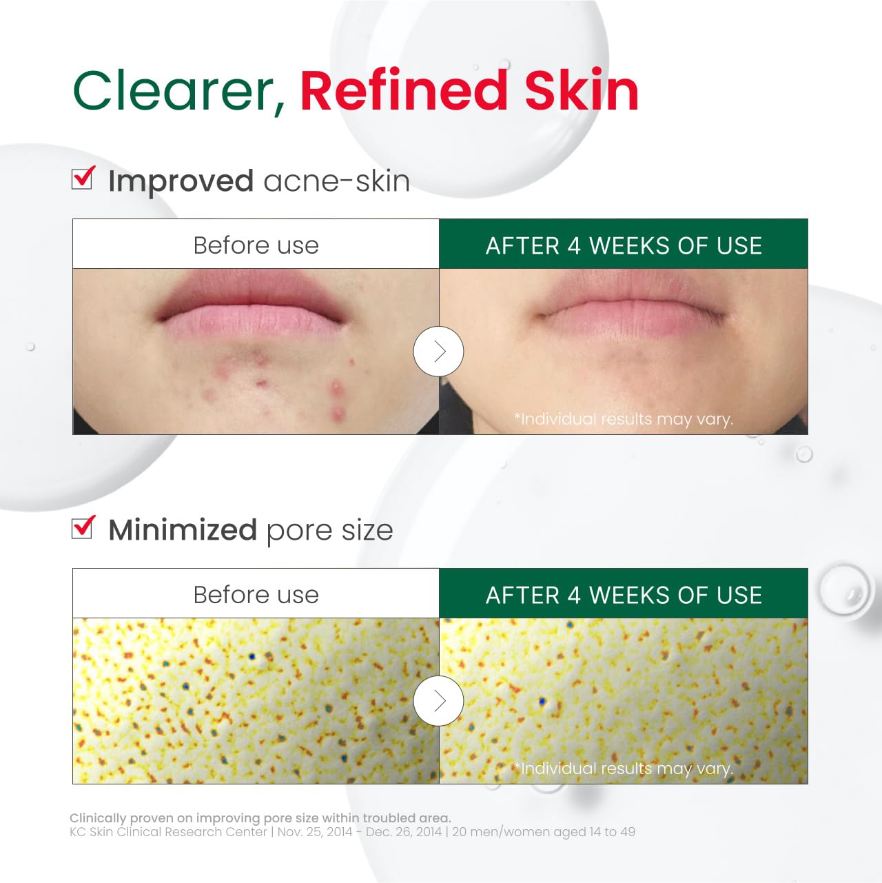 Dr.G R.E.D. blemish clear serum hyaluronic acid detail emphasizes deep hydration