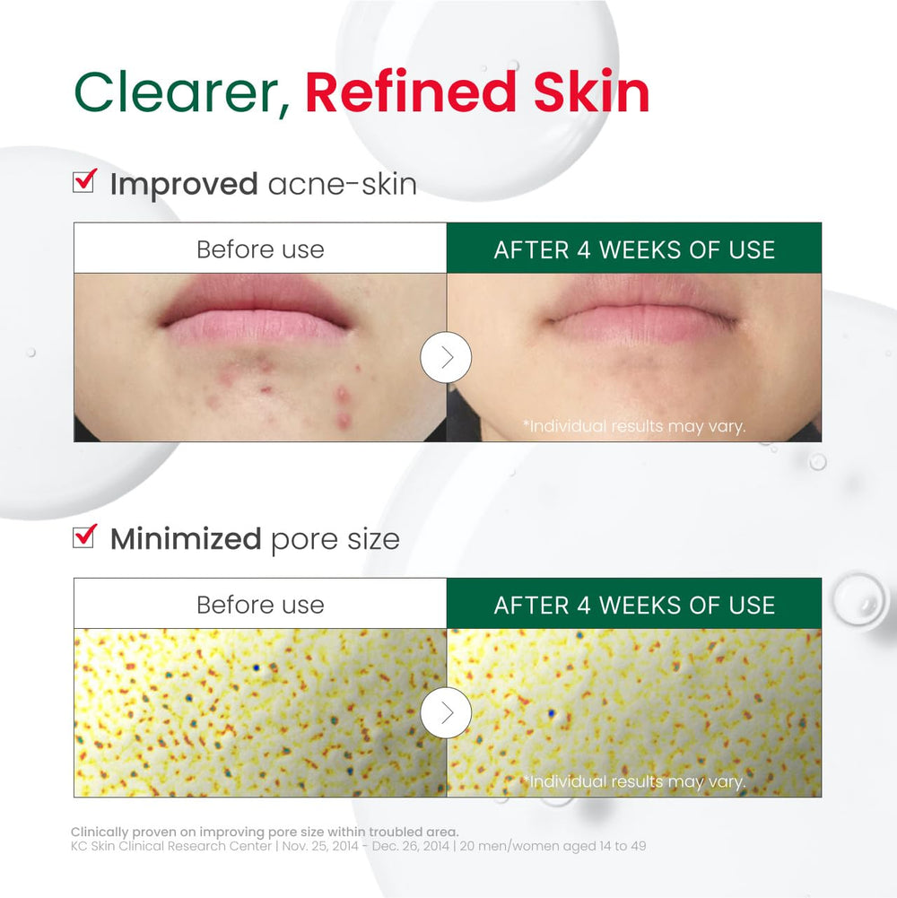 Dr.G R.E.D. blemish clear serum hyaluronic acid detail emphasizes deep hydration