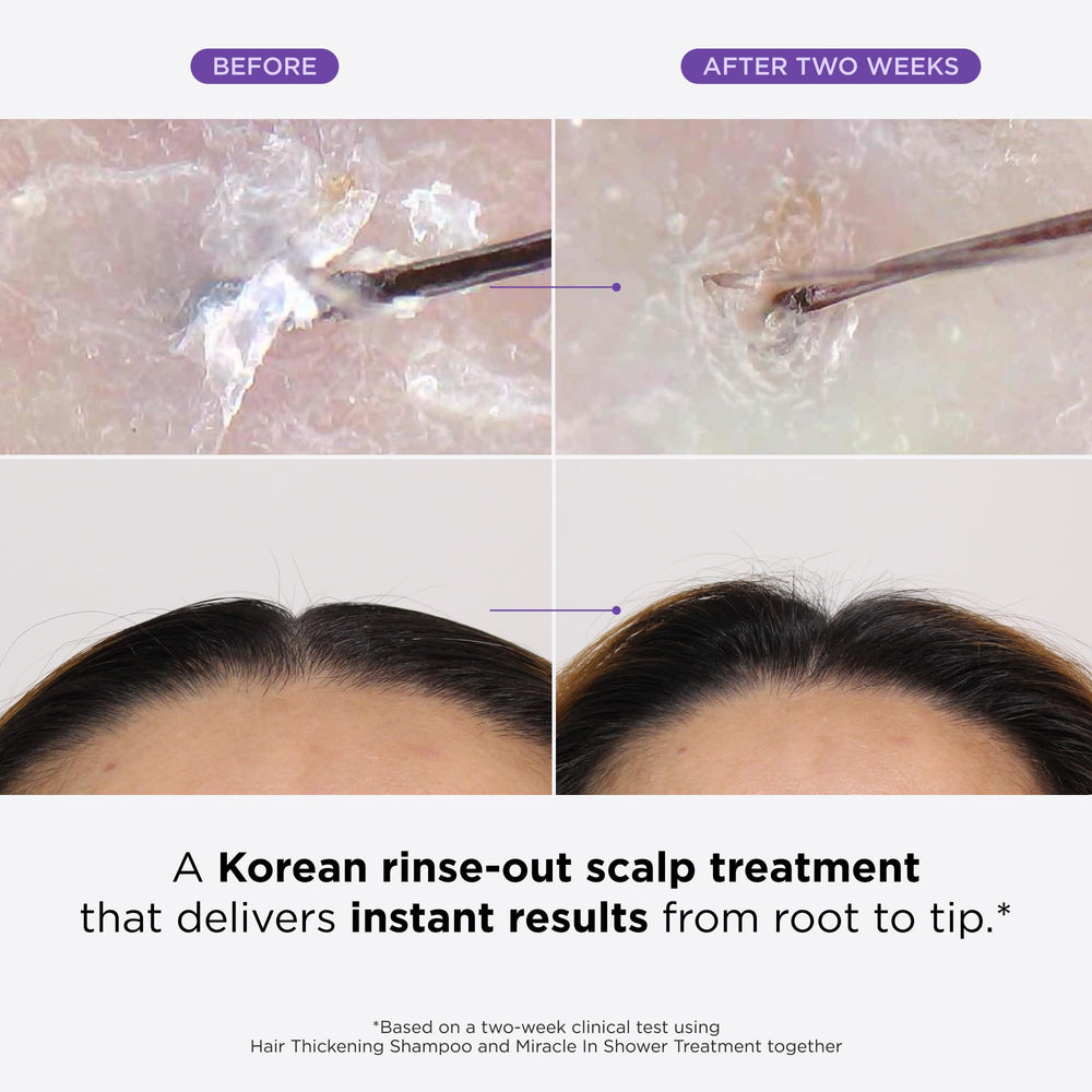 Dr. Groot Miracle in Shower application glide illustrating quick scalp treatment