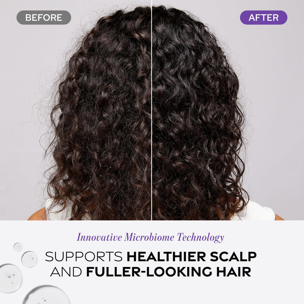 Dr. Groot Scalp Detox Water exfoliating action enhances buildup removal during regimen