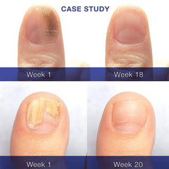 Dr. Luke Nail Repair Liquid brush application on clean nails for quick daily care.