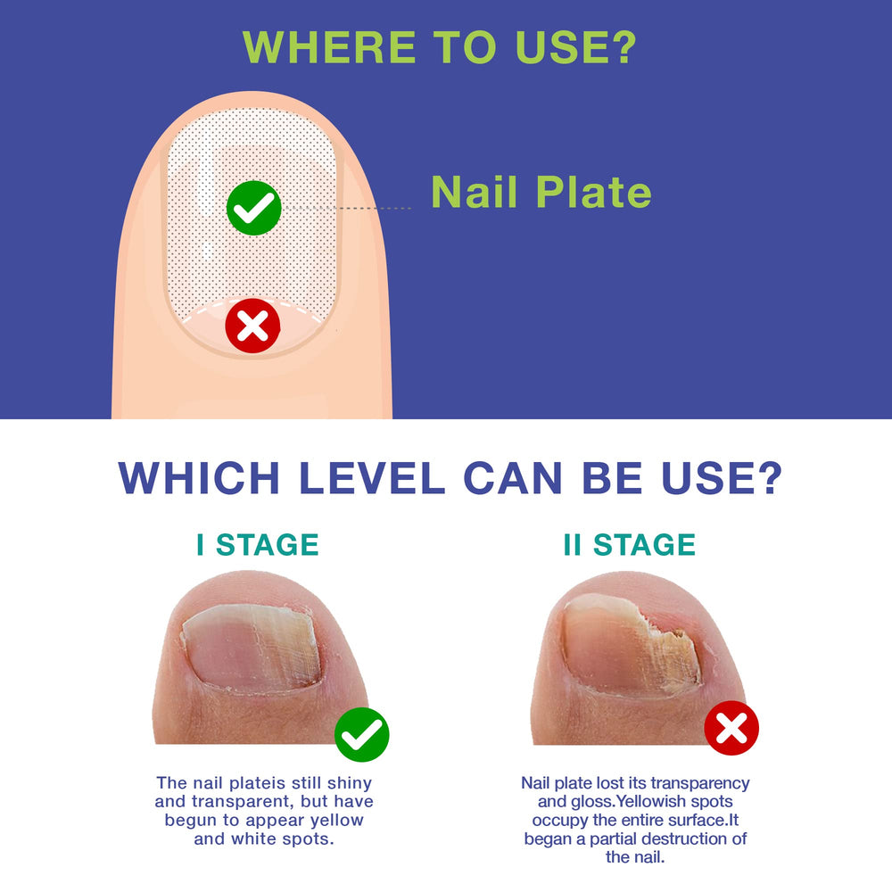 Dr. Luke Nail Repair Liquid close-up shows thin layer for improved nail appearance.