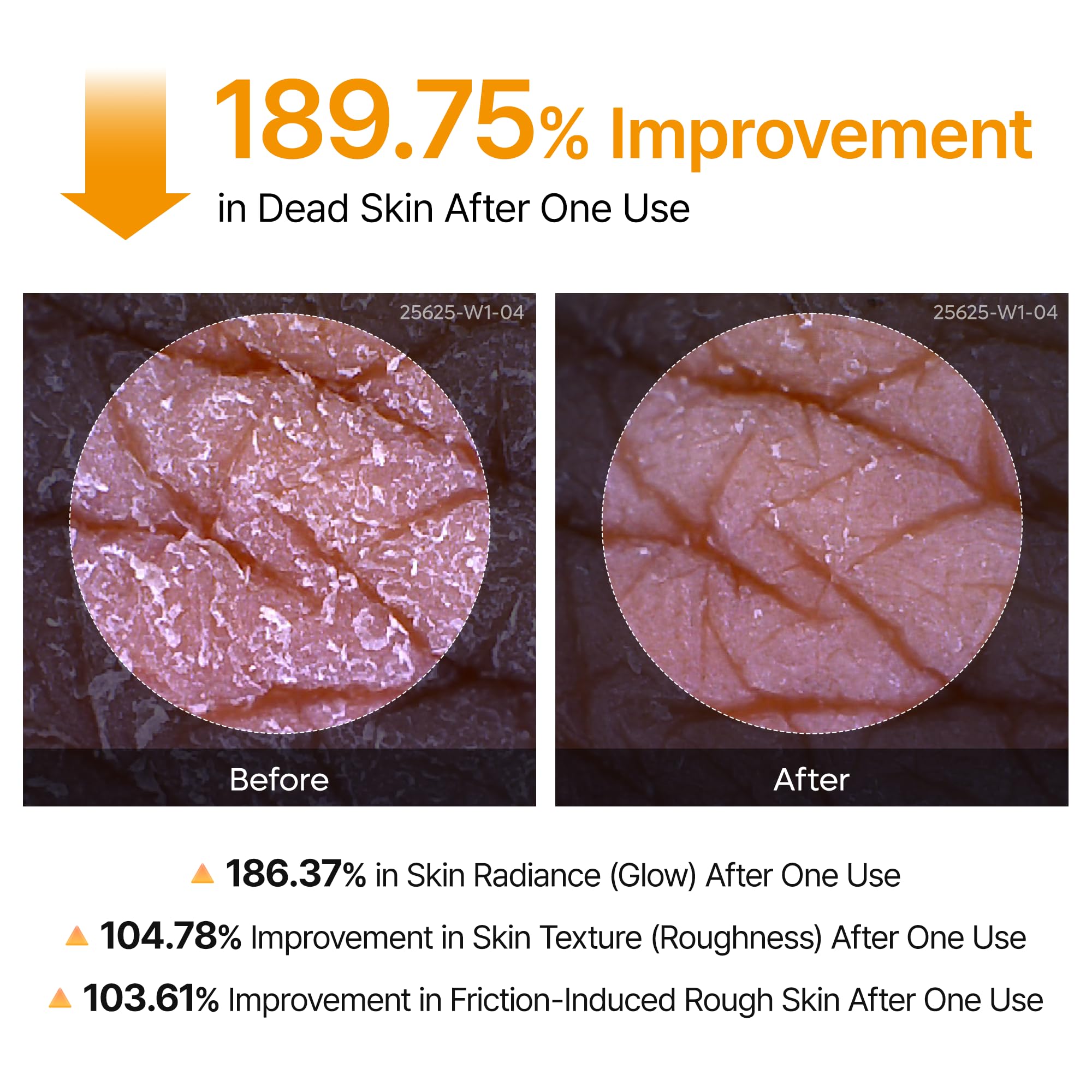 Dr.Melaxin body-peeling-solution-closeup implies mild exfoliation and renewal.
