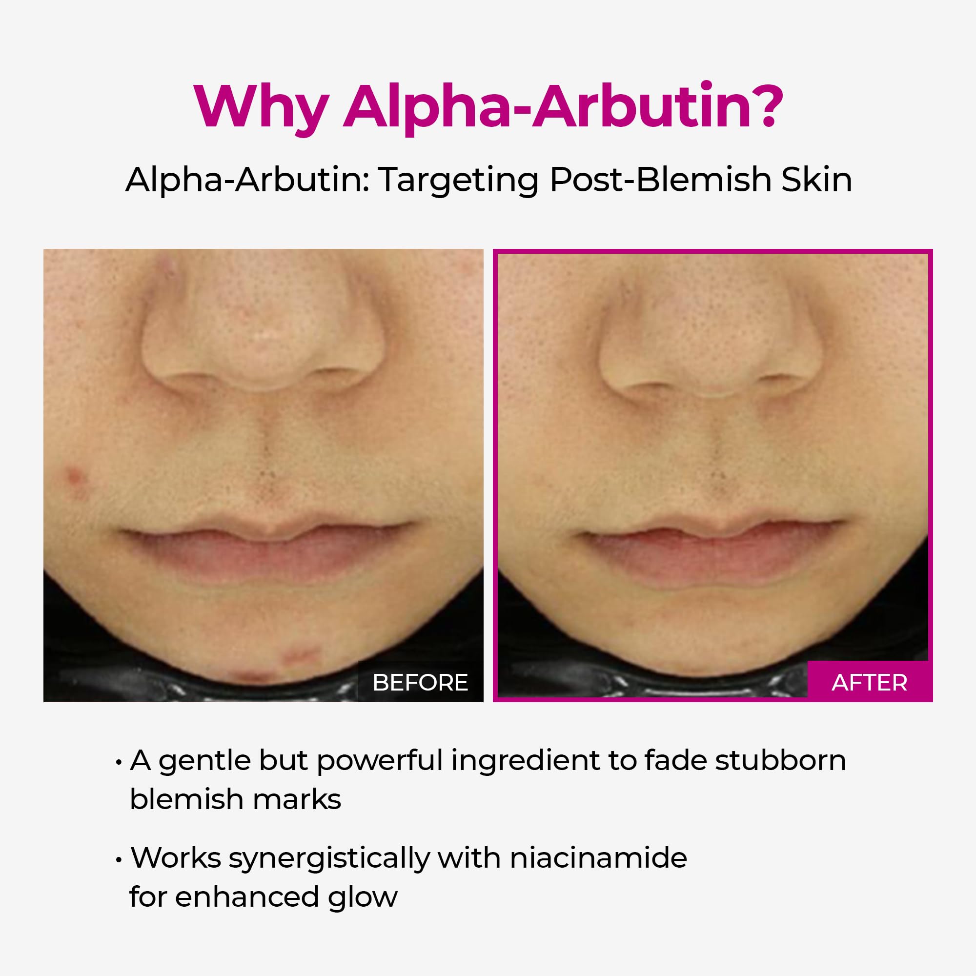 Dr.Melaxin Cemenrete Shot serum swirl on skin shows radiant complexion