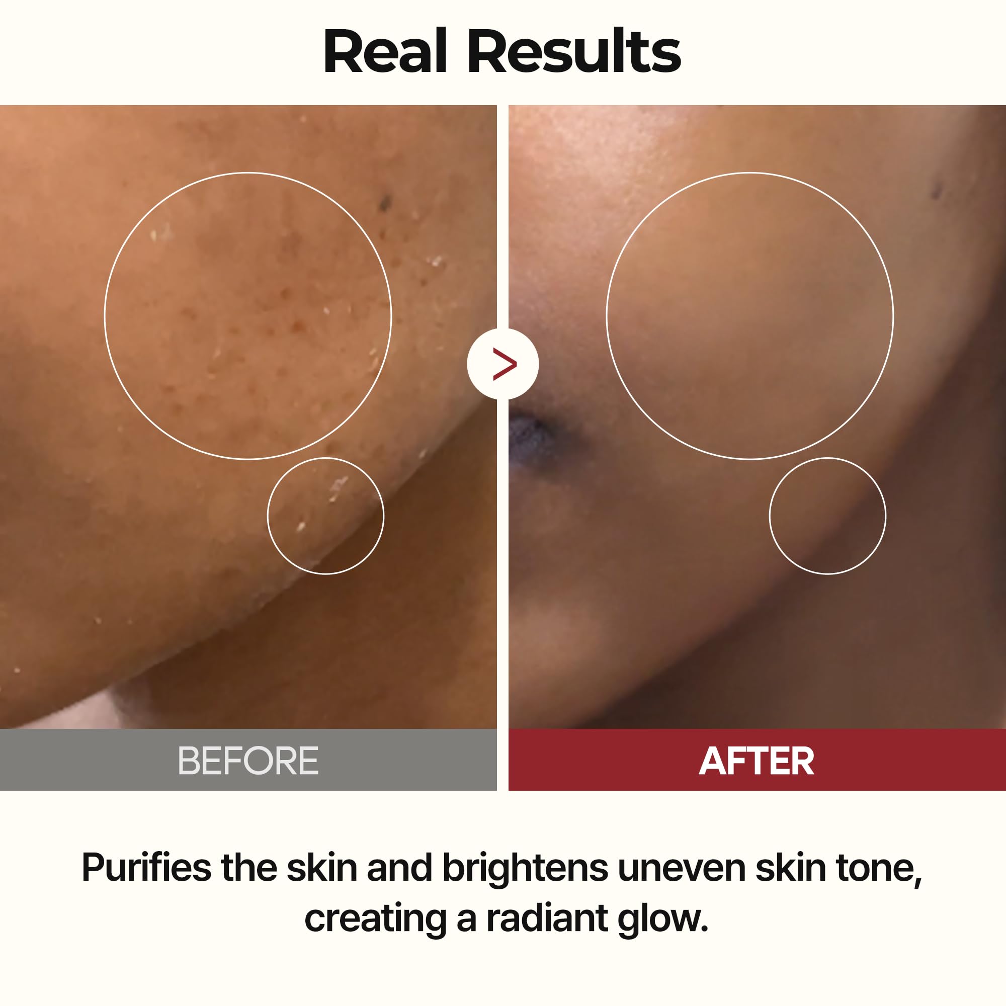 Dr.Melaxin fermentation diagram highlights vitamin B–rich nutrients for skin nourishment.