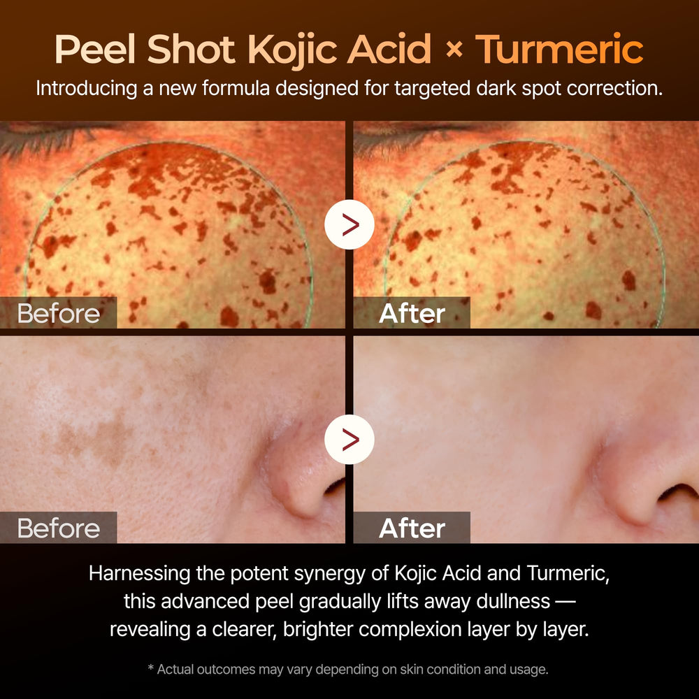 Dr.Melaxin Turmeric Serum swirl texture suggests luminous, even skin tone.