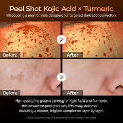 Dr.Melaxin Turmeric Serum swirl texture suggests luminous, even skin tone.