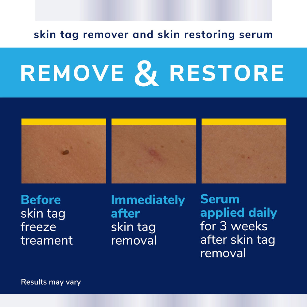 Dr. Scholl's Complete Care before-and-after skin after removal showing restored appearance.