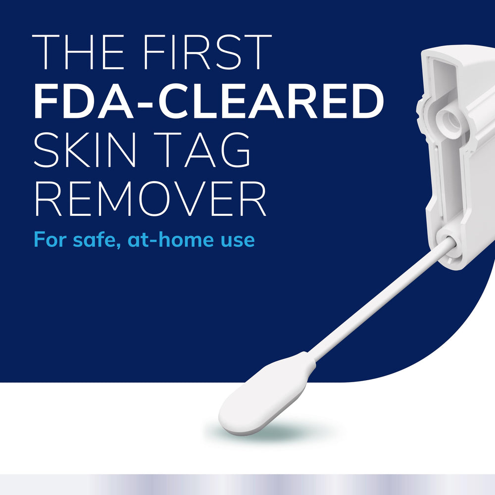 Dr. Scholl's Complete Care Skin Tag Remover steps in-hand highlighting the simple 5-step process.