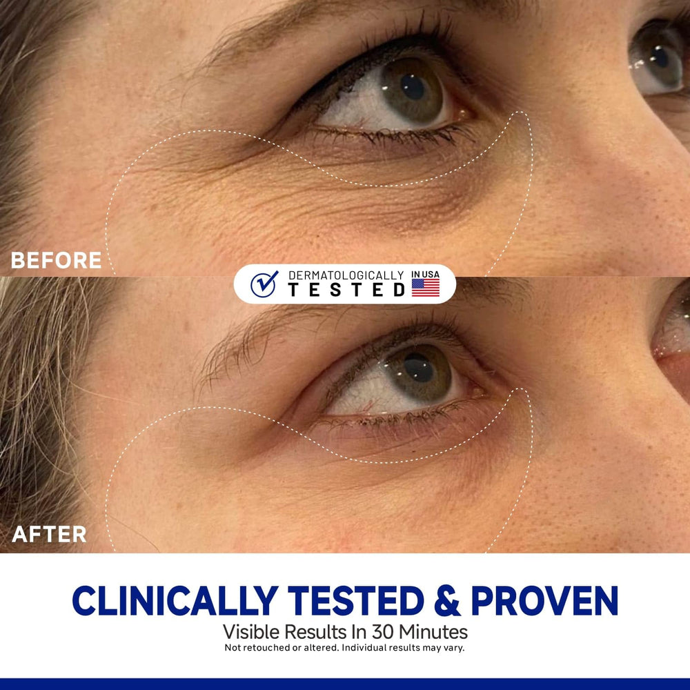 Dr Vincent peptide jojoba under-eye patches being applied for secure fit during day