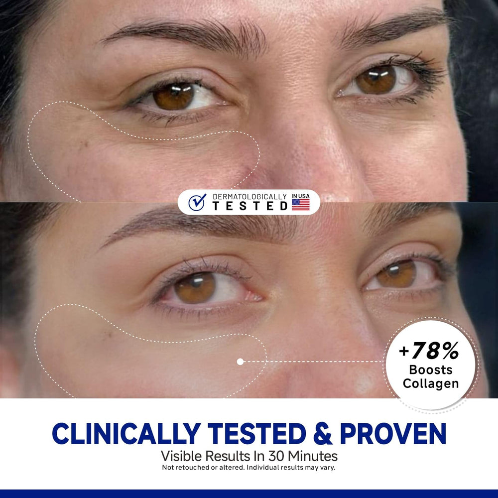 Dr Vincent peptide patches on eye demonstrate proper placement for soothing, non-slip wear.