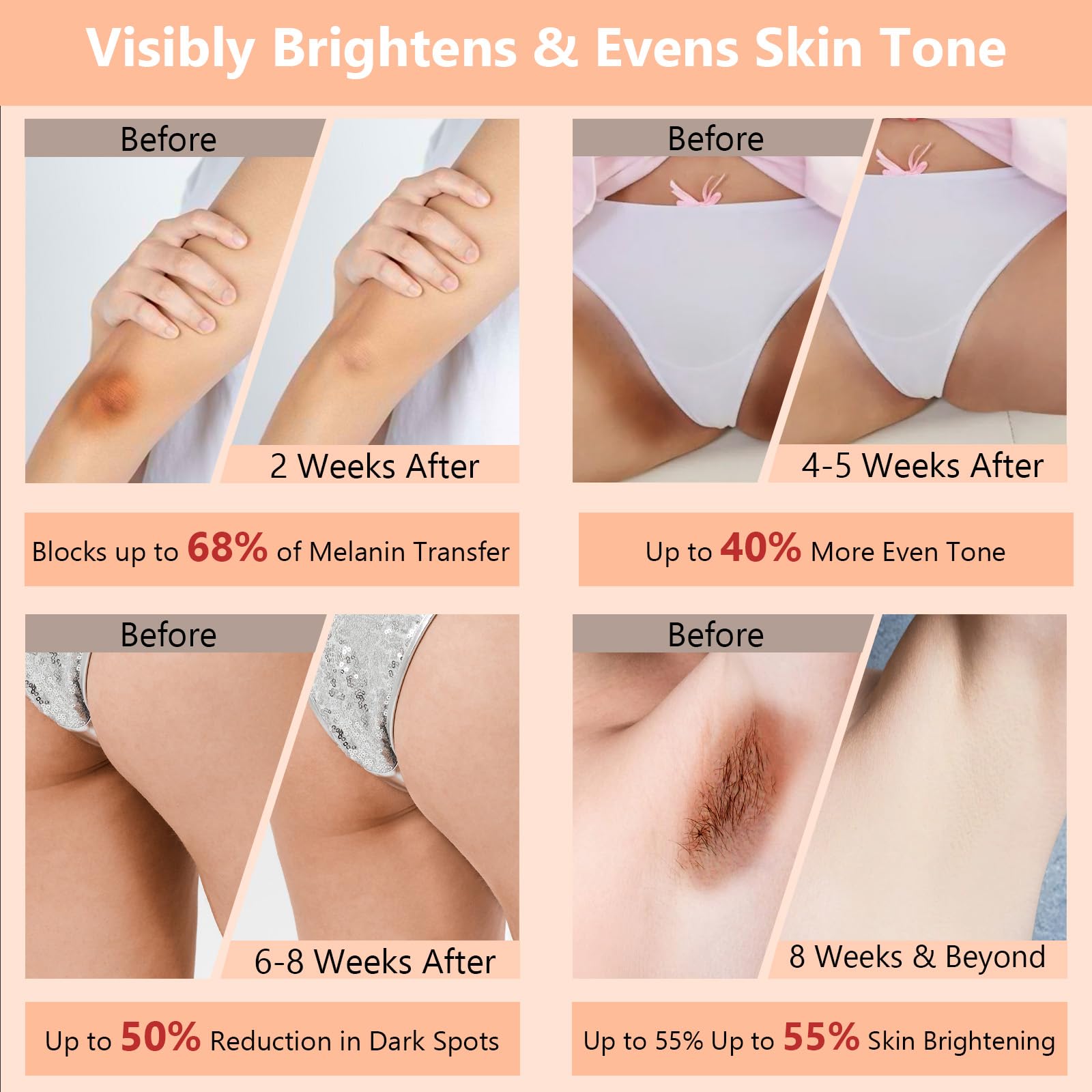 DR.Afanyr Skin Bleaching Cream bikini-line close-up emphasizes gentle brightening and smoother skin