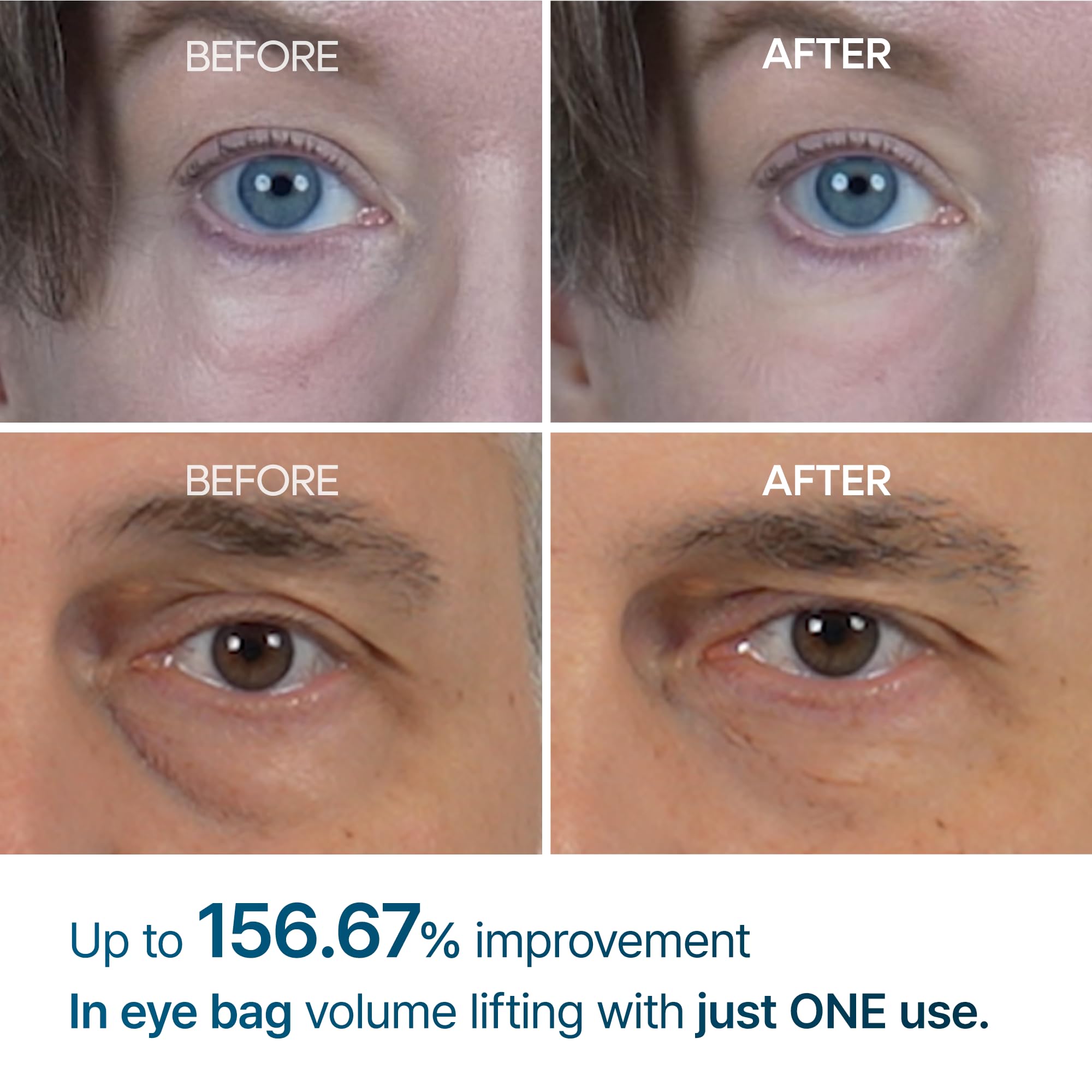Dr.Melaxin Eyephalt apply demo demonstrates gentle patting for puffy eyes.
