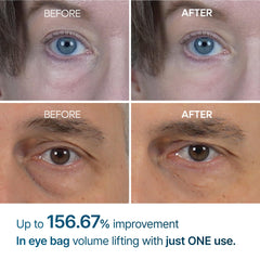 Dr.Melaxin Eyephalt apply demo demonstrates gentle patting for puffy eyes.