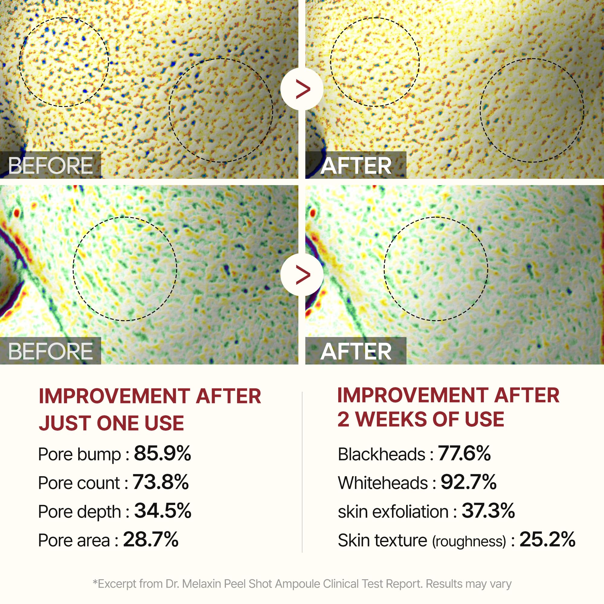 Dr.Melaxin Peel Shot Glow pores appear refined after use
