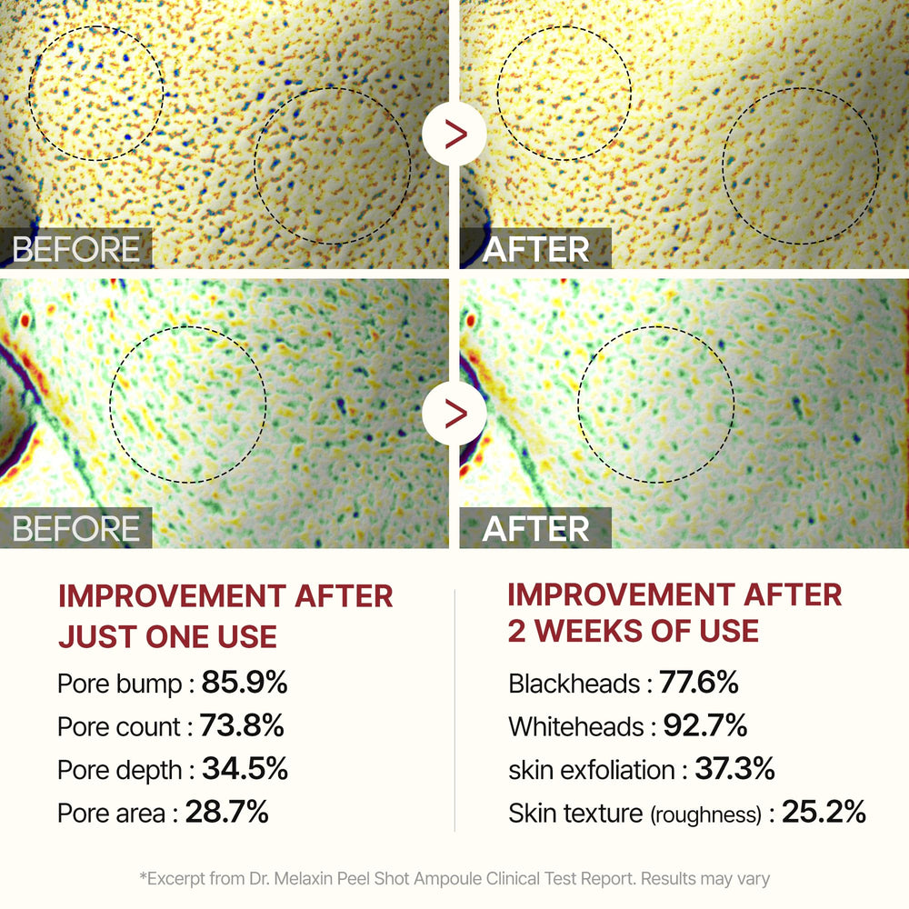 Rice bran water hydration image emphasizes plump, hydrated skin.
