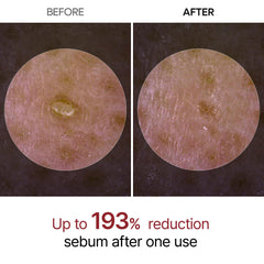 Dr.Melaxin Peel Shot Glow rice extract ingredient detail
