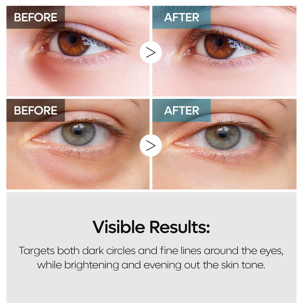 Dr.Melaxin TX Adenosine Niacinamide close-up shows even tone and refreshed look.