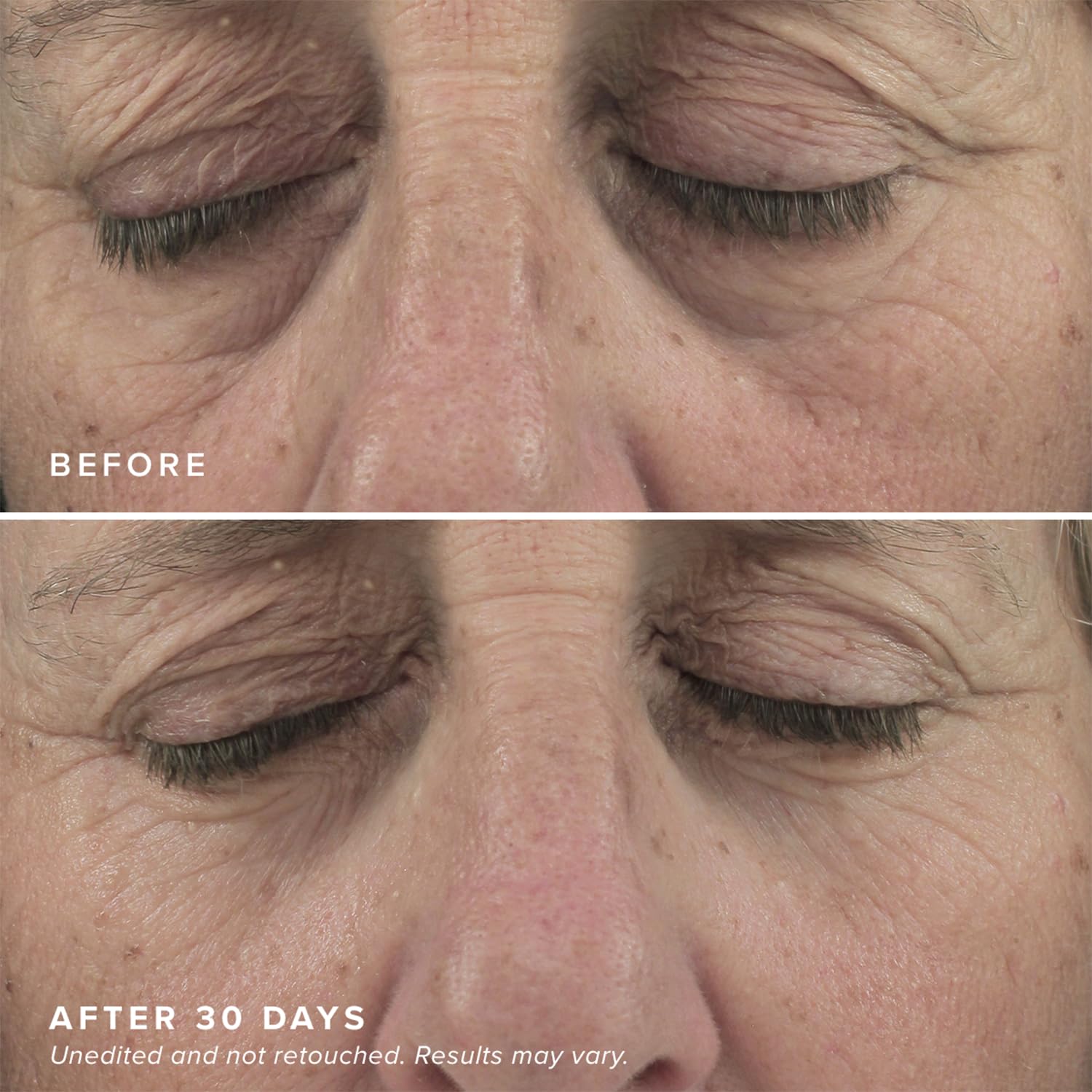 DRMTLGY Eye Masks with caffeine for refreshed-looking eyes.