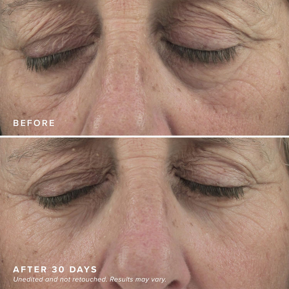 DRMTLGY Eye Masks with caffeine for refreshed-looking eyes.